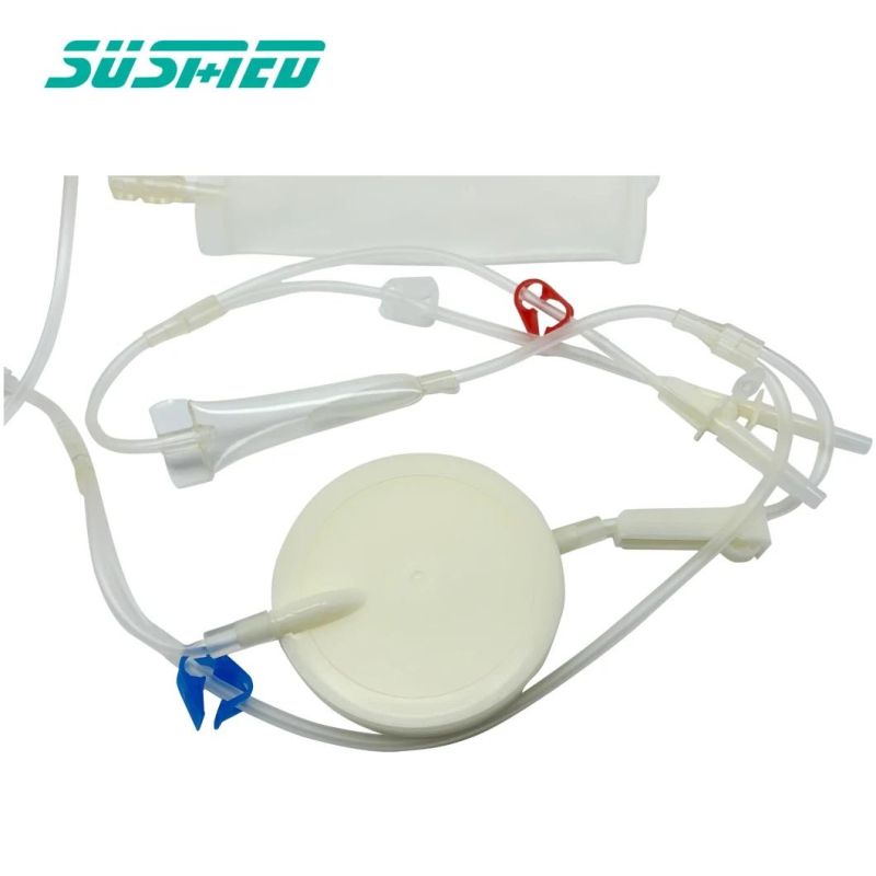 Leukocyte Reduction Filters for Single Use Blood Bank