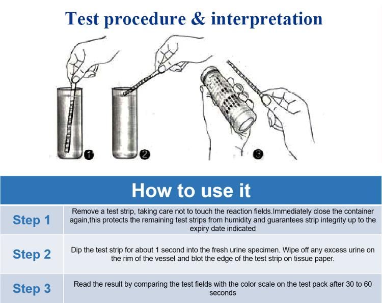 Whole Sell Sterile 4 10 11 Parameter Urine Test Strips for Medical with CE ISO