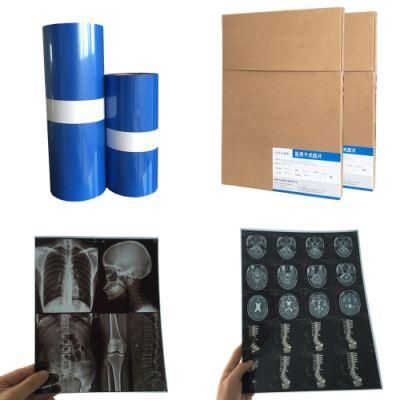 X-ray Laser Medical Film Blue Color for FUJI Printer