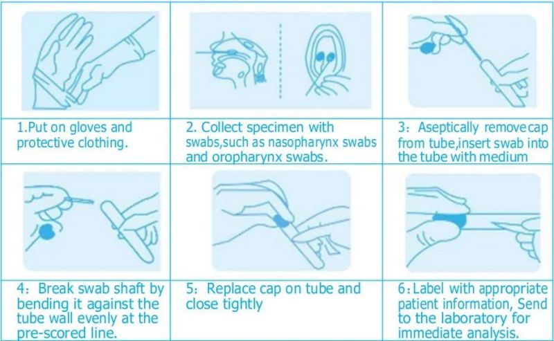 3ml Universal Vtm Sampling Tube Virus Transport Medium with Transfer Nasopharyngeal Sterile Swab Test Kit