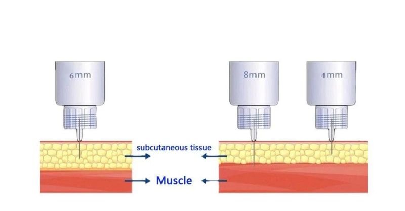 Medical Disposable Insulin Pen Needle for Diabetes