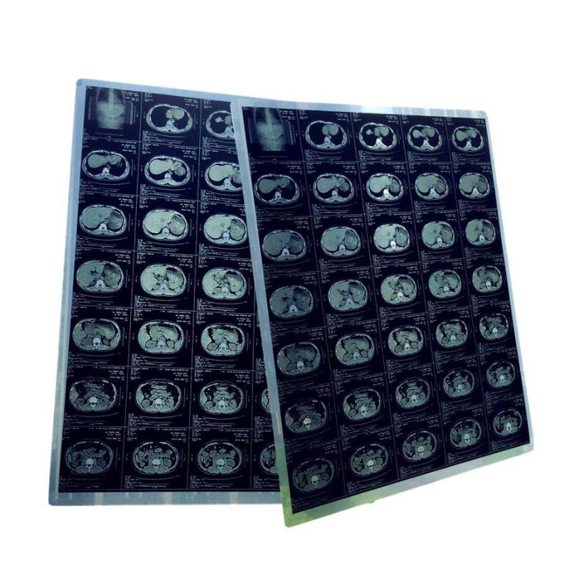 150 Micron A4 Size Inkjet Medical X-ray Blue Dry Film