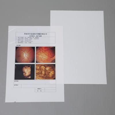 Inkjet Digital White X Ray Film for Ultrasound Dr MRI Imaging Printing