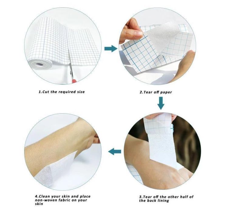 Mdr CE Approved Surgical Adhesive Dressing Tape Blue Latticed with a Five-Year Shelf Life