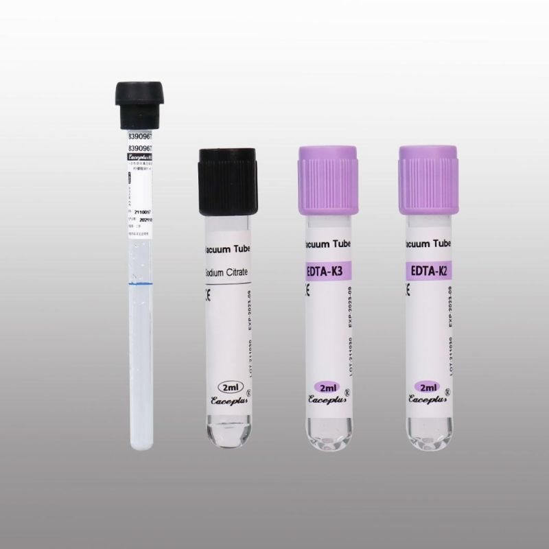 Siny High Quality 2-10ml EDTA K2 K3 Plain Red Purple Cap Vacuum Blood Collection Tube with CE