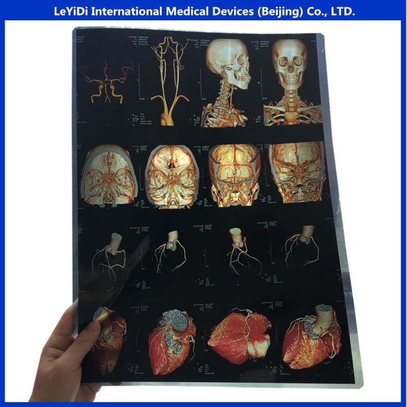 Dry Imaging Printer Films X-ray Film 11*14 Inch