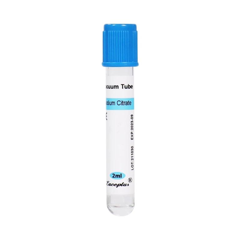 Siny Factory Price Disposable Vacuum Blood Collection Tube Sodium Citrate Tube with CE