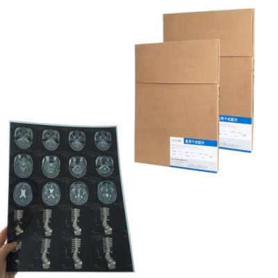 Blue Color Inkjet Digital X Ray Film for Canon Inkjet Film Printer with 35X43cm