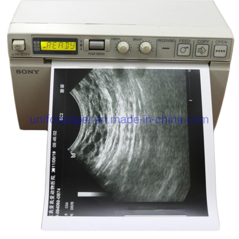 High Glossy Ultrasound Thermal Printing Paper Sony Upp-110hg High Brightness