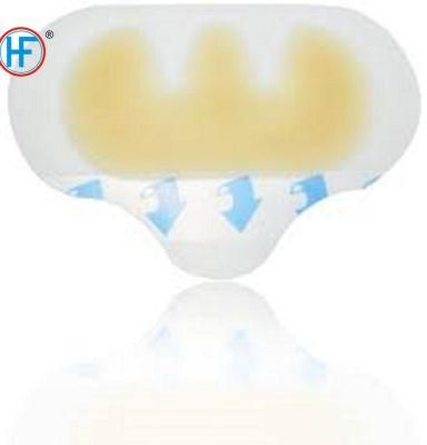 Mdr CE Approved Disposable Safety Non-Woven Fabric Wound Dressing Plaster