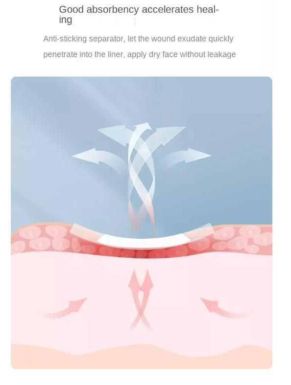 Medical Sterile Non Woven Medical Dressing Waterproof Material Sterile Adhesive Wound Dressing