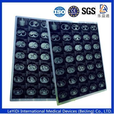 8*10 and 14*17 Inch Blue Thermal X-ray Films