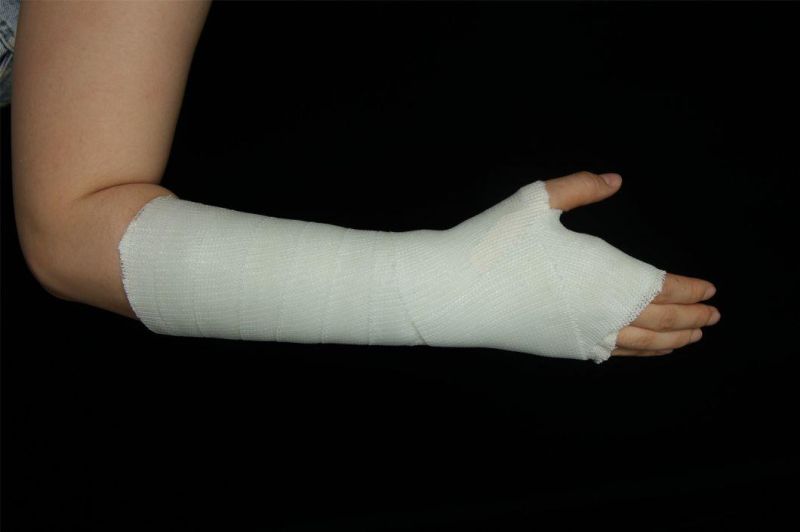 Fiberglass Orthopedic Splint Elastic Bandage for Ankle Joint Fractured Bone External Fixation