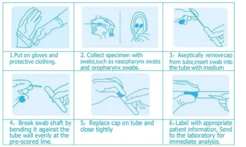 Nasal or Throat Swab Disposable Virus Collection Vtm Kit with 10ml Tube