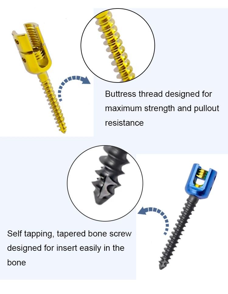 China Manufacture Monoaxial Reduction Screw Spinal Fixation Screws Orthopedic Surgical Implants