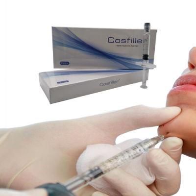 Sterile Dermal Filler Injectable Ha Cross-Linked Hyaluronic Acid Filler for Cheek Nose