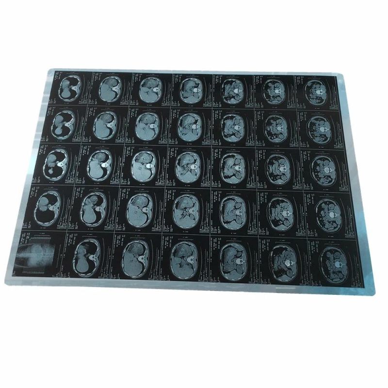 14*17 and 8*10 Inch Blue Thermal X-ray Dry Films