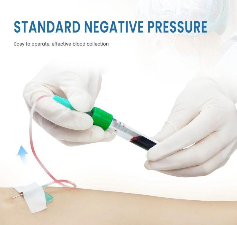 Wego Medical Supplies Colorful Irradiate Vacuum Blood Collection Tube Blood for Single Use