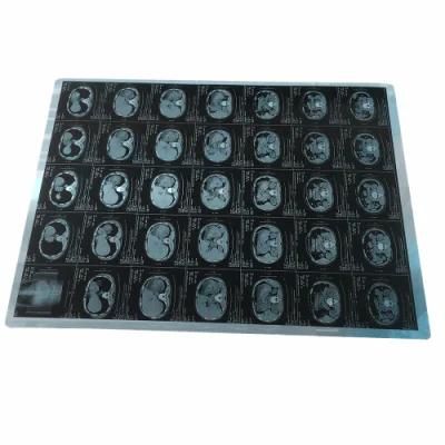 14*17 Inkjet Medical X-ray Blue Film