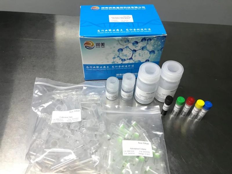 Rna Detection Kit PCR-Fluorescence Probing Virus Nucleic Acid Extraction Test Kit New Infectious Diagnostic Immunodeficiency Antibody Test Antibody Test