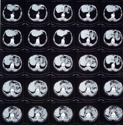 China Inkjet Printing Medical Imaging Film/Agfa Medical Thermal Films