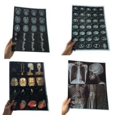 Hospital Medical Dry Blue 8X10 Inch Inkjet Blue Color Films