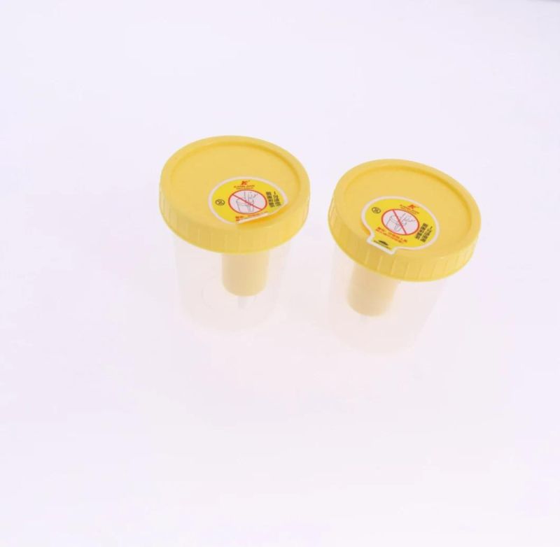 Disposable Urine Cup Vacuum Urine Specimen Container Cup