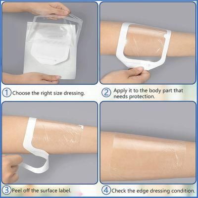 Disposable Dressing Breathable Waterproof Wound Transparent Film Pad