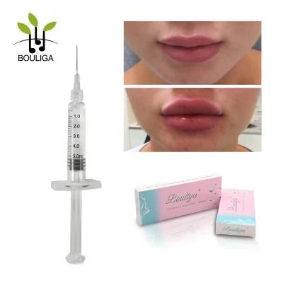 Hyaluronic Acid Dermal Filler Injections Lip Enlargement Filler Deep 2ml