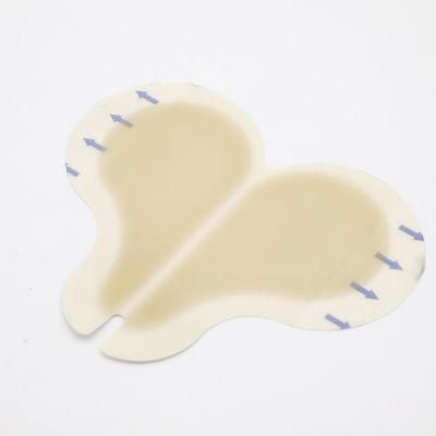 Sterile Adhesive Hydrocolloid Wound Care Dressing