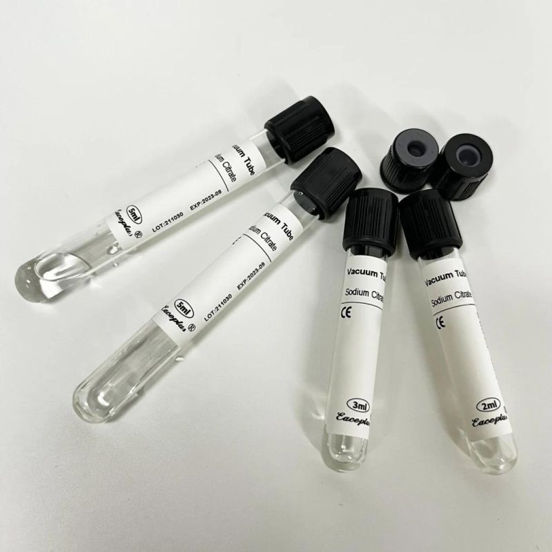 Siny Disposable Medical Supplies ESR Test 3.8% Sodium Citrate Vacuum Blood Collection Test Tube with CE