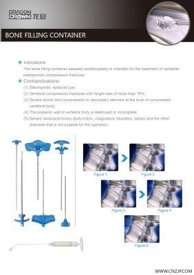 Spinal Implants for Osteoporosis Compressed Fracture