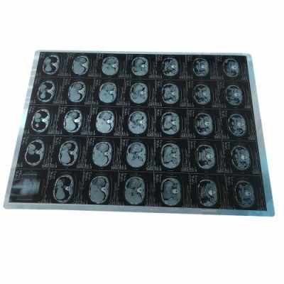 Medical Transparent Blue Film with Thermal Printer