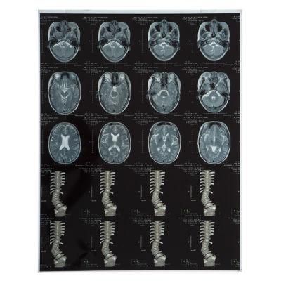 A4 Blue Base Inkjet Medical X-ray Film