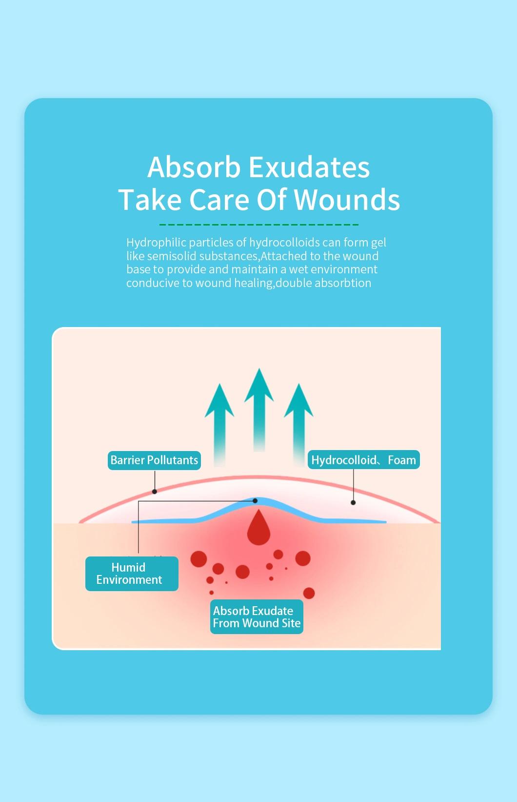 Hydrocolloid Foam Dressing Is Suitble to Bleeding Wounds