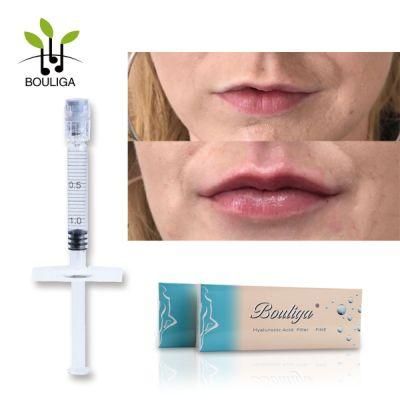 2ml Dermal Filler Injectable Hyaluronic Acid for Lip and Nose