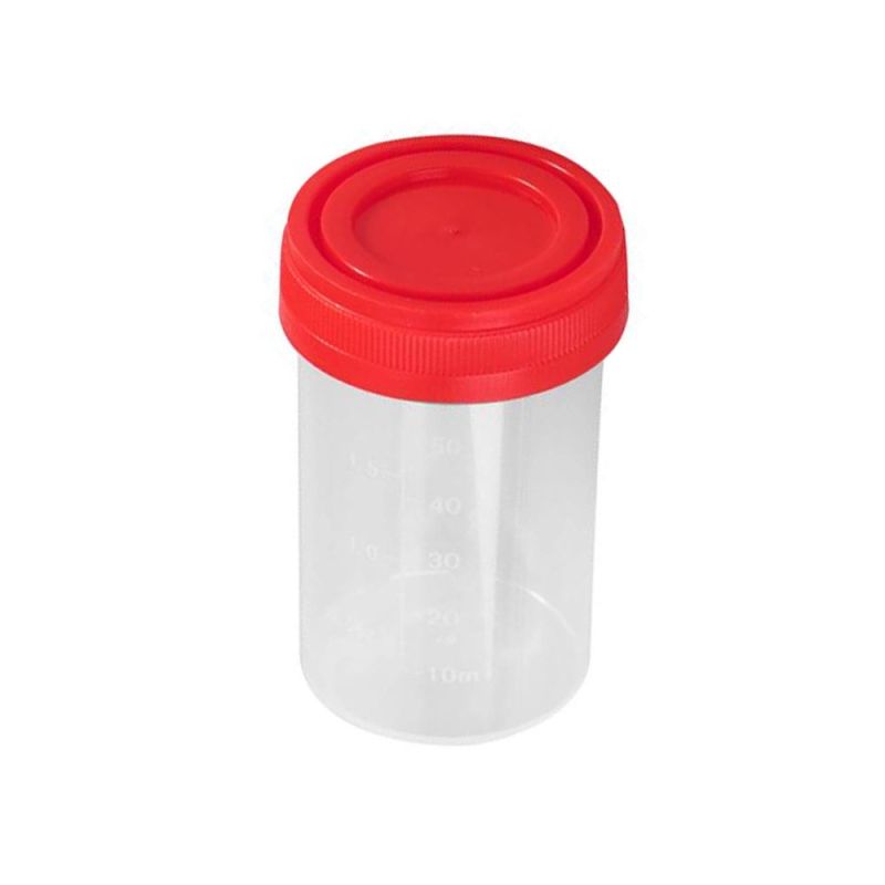Non Sterile Urine Cup Bulk Pack Urine Container 30ml 60ml 120ml