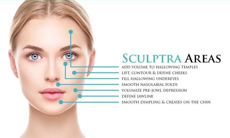 Facial Injection Surgery Plla Polylactic 3D Poly-L-Lactic Acid Sculptr Wrinkles Remove Lifting Dermal Filler