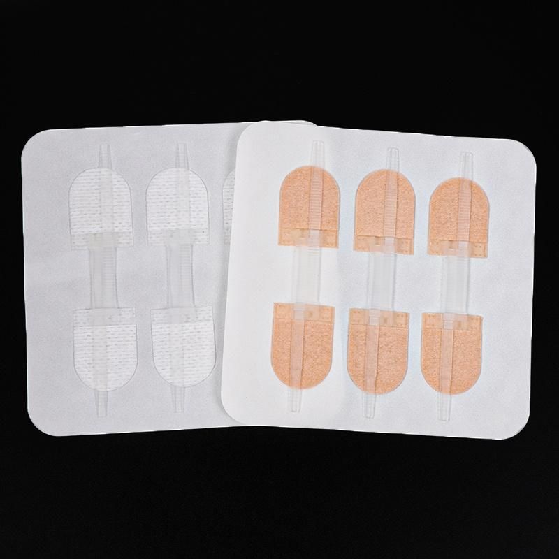 Special Hot Selling Medical Products Surgical Wound Suture Patch Zipper Type
