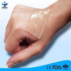 Quality Hydrocolloid Wound Dressing Improving Wound Healing18