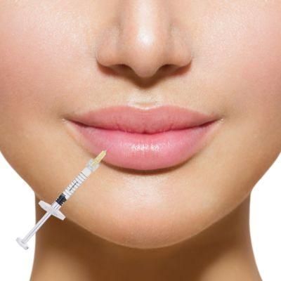 Hyaluronic Acid Injection Dermal Filler with Lidocaine