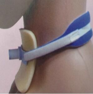 Endotracheal Tracheal Tube Holer Adjustable Device Manufacturer