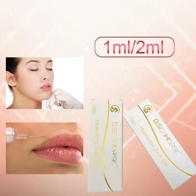 Deep Subskin Cross Linked Ha Gel Dermal Filler