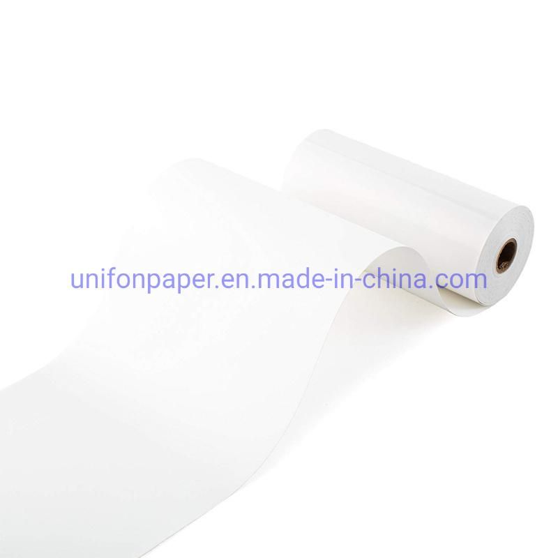 MD400 Ultrasound Machine Upp 110s Ultrasound Thermal Paper for Sony Video Pronter
