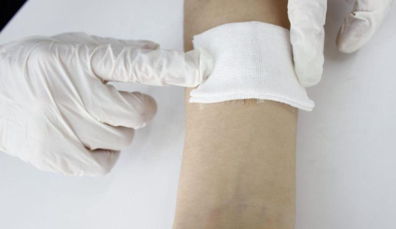 Adhesive Wound Closure Steri Strip Skin Wound Closure
