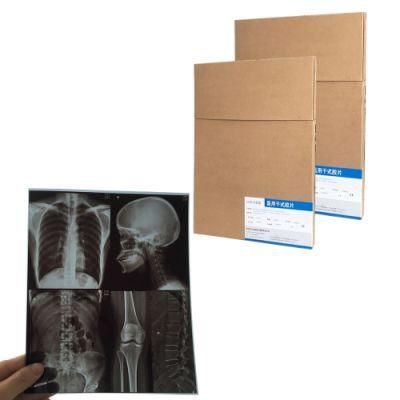 13X17 Inch Laser Blue Medical X-ray Film for FUJI Laser Printer