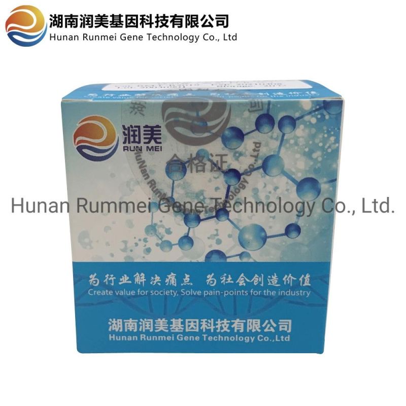 Rna Detection Kit PCR-Fluorescence Probing Virus Nucleic Acid Extraction Test Kit New Infectious Diagnostic Immunodeficiency Antibody Test Antibody Test