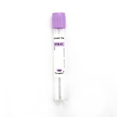 Siny Medical Blood Collection Glass Tube EDTA K2 K3 Tube Plain Tube with CE