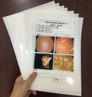 Hot Sale Medical White Inkjet Film for Ultrasound Medical Diagnosis Reports