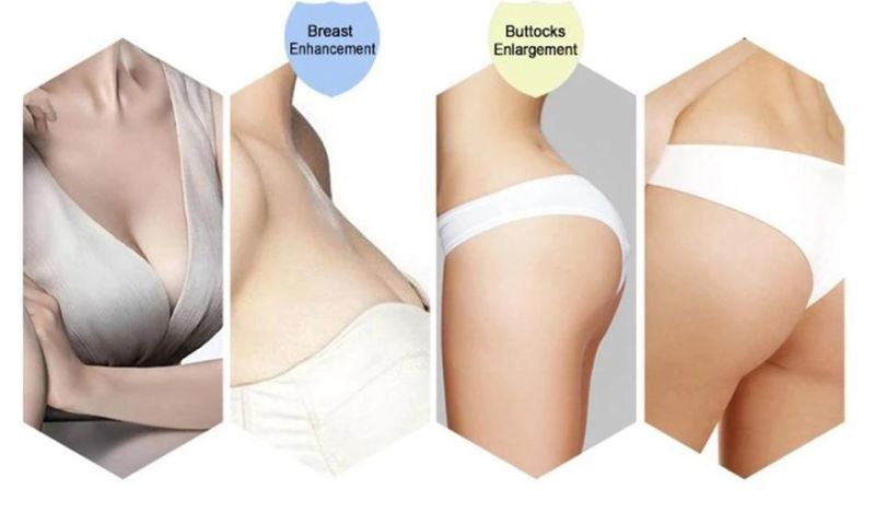 Butt Implants Gel Ha for HIPS Buttocks Filler Enlargement Injection